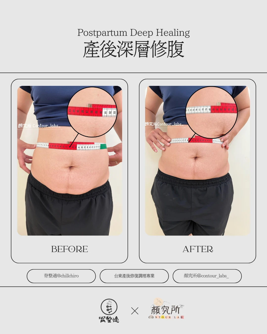產後腹部重塑案例，腰圍測量調理前後比較