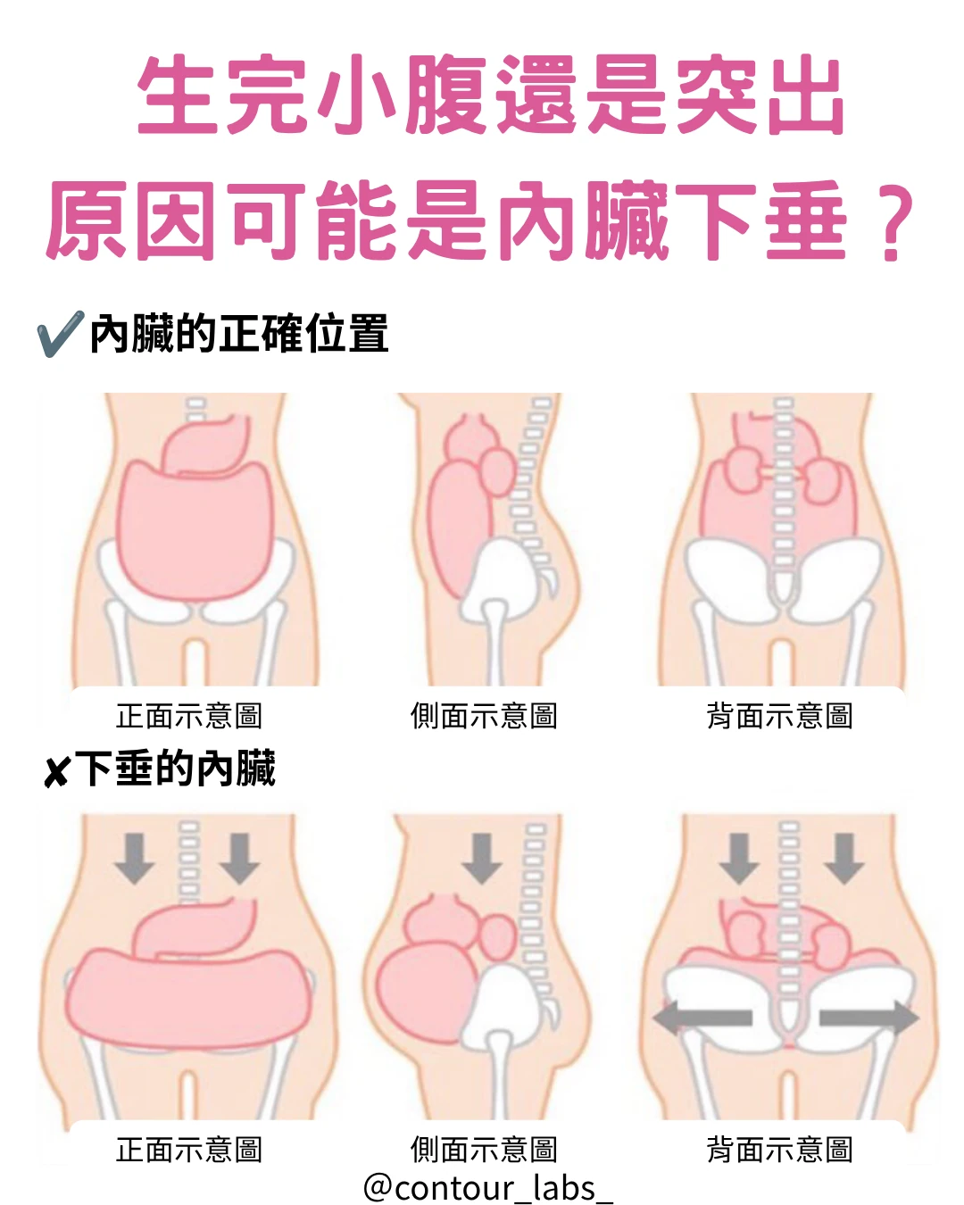 產後內臟下垂與小腹突出關係示意圖